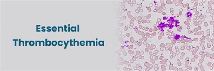 Courageous Stars: Celebrities With Essential Thrombocythemia