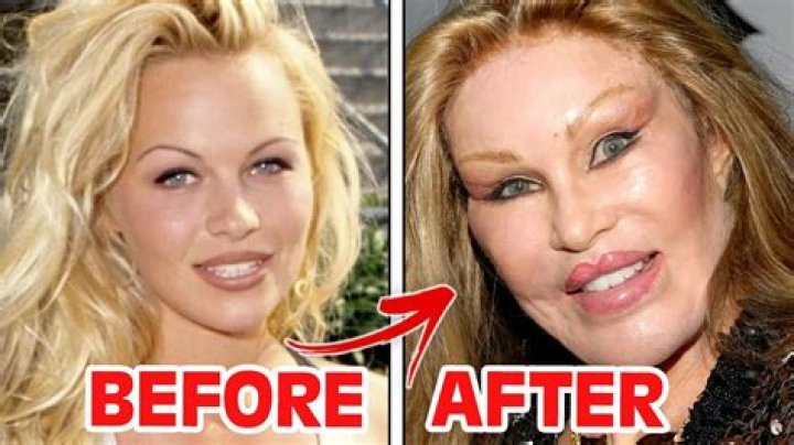 Has Jonathan Cheban Had Plastic Surgery? 